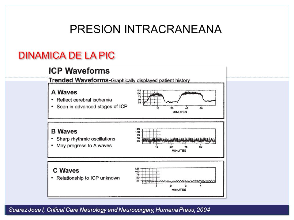 Formas de onda intracraneales